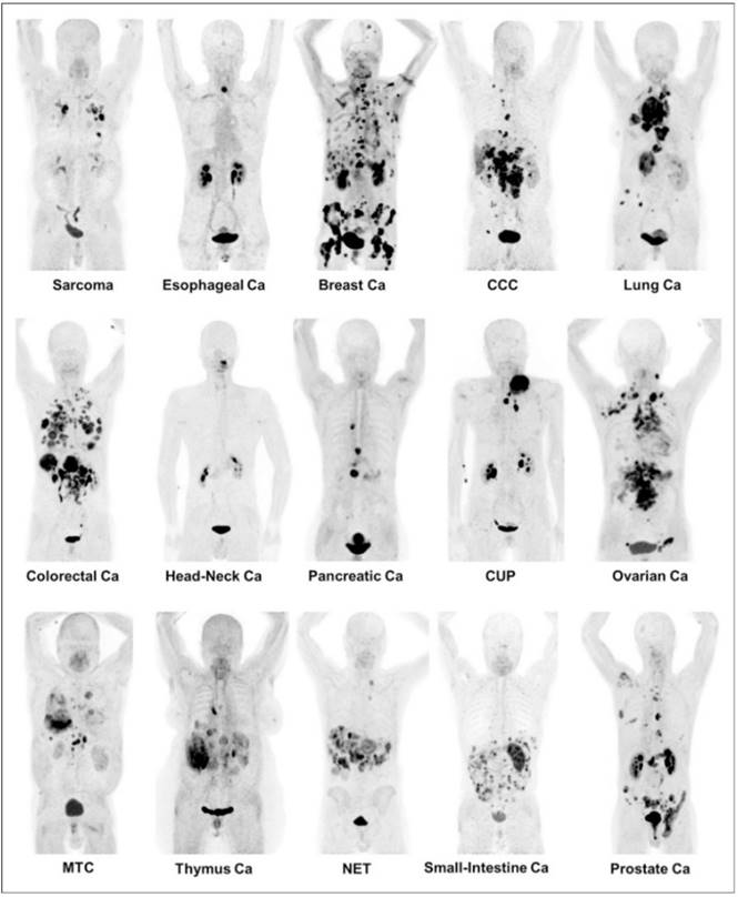 核醫診療賽道上的FAP分子們
