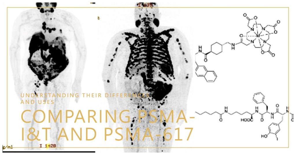 PSMA-I&T vs PSMA-617:&nbsp;兩者一樣嗎?