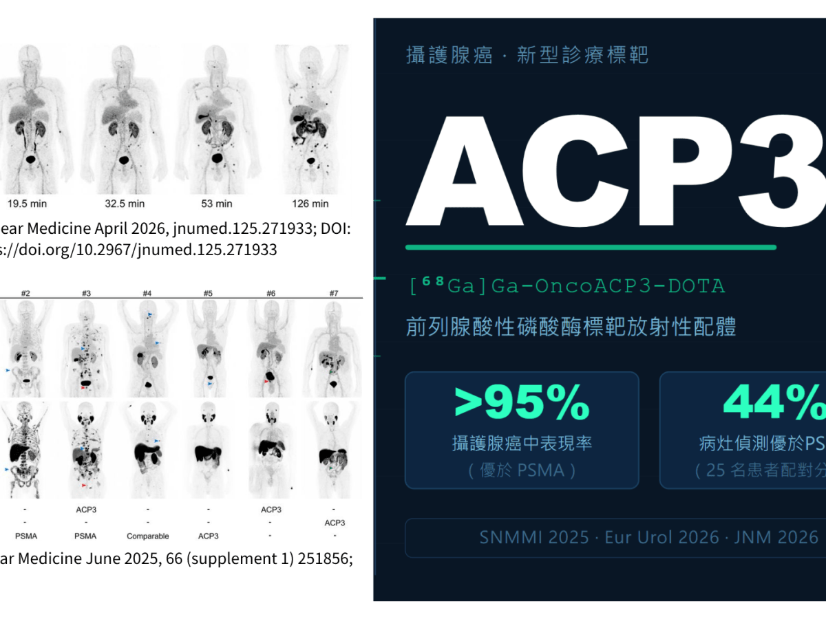 攝護腺癌診療標靶新星—ACP3：